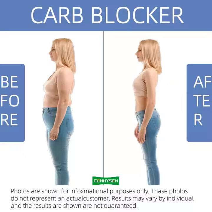 L Theanine Slim Fat Burner كبسولات الليل يدعم إدارة الوزن OEM ODM