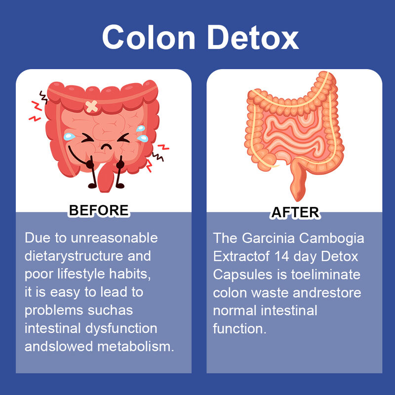 علامة خاصة كبسولة 14 يوماً حمينة تدعم صحة الجهاز الهضمي وفقدان الوزن مكمل غذائي كبسولة إزالة السموم